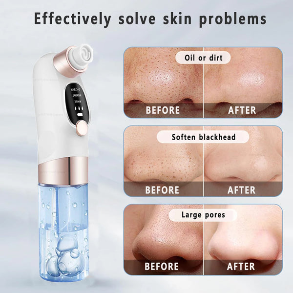 Clear Skin Pore Vacuum