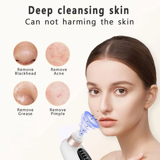 Cordless Facial Pore Vacuum Extractor