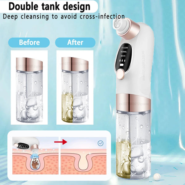 Blackhead-Remover-Pore-Vacuum-Face-Cleaner-Electric-Pimple-Acne-Black-Head-Removal-USB-Rechargeable-Water-Cycle.jpg
